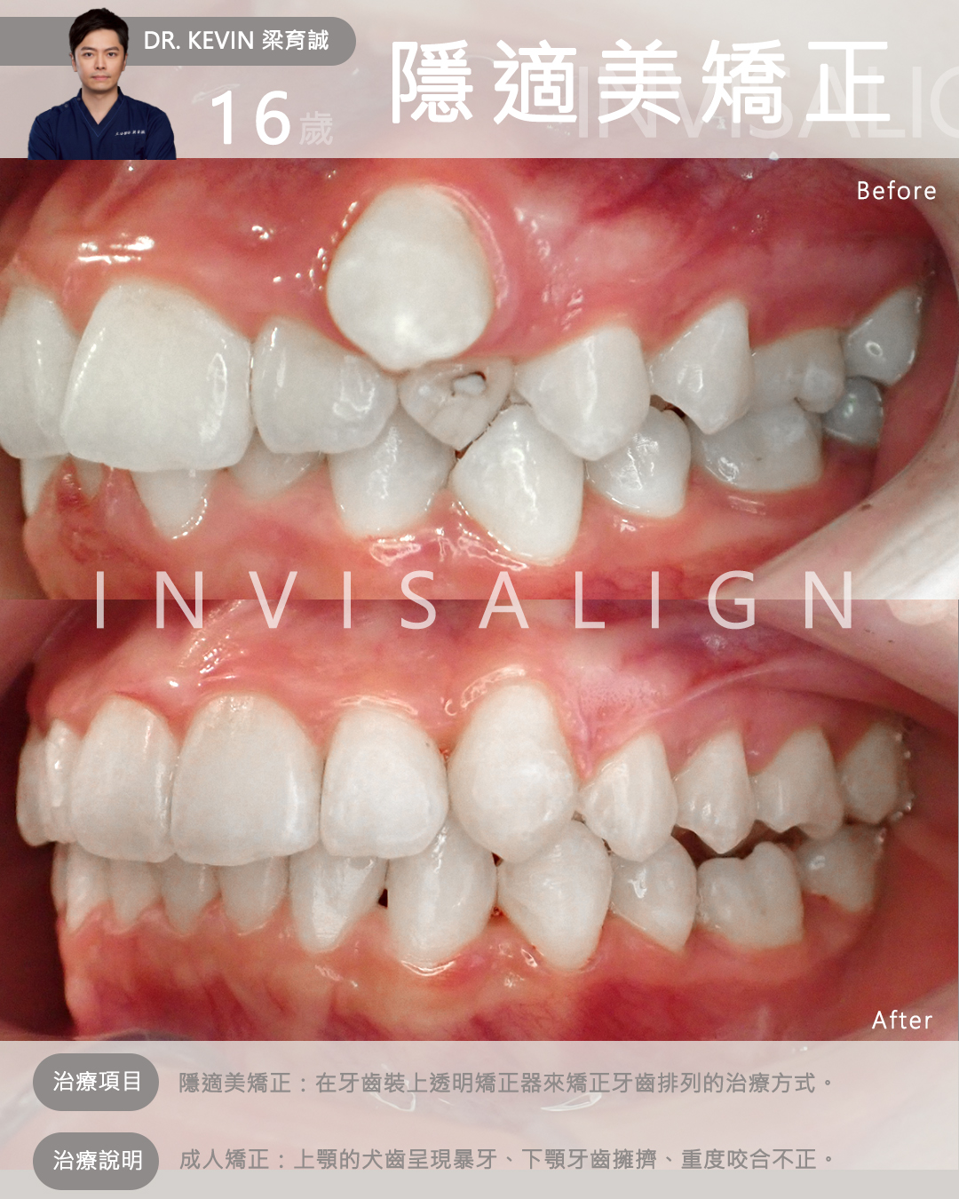 case_4